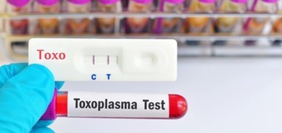  בדיקת נוגדני טוקסופלסמה (Toxoplasma IgM) - תמונה